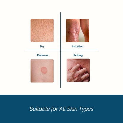 foru. Natural Eczema Cream with Oat and Prebiotics - eczema type